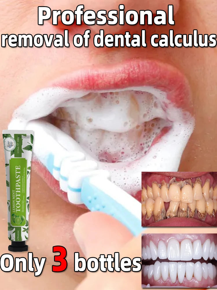 remover dental calculus whitening teeth mouth odor removal bad breath Preventing Periodontitis [DEN]