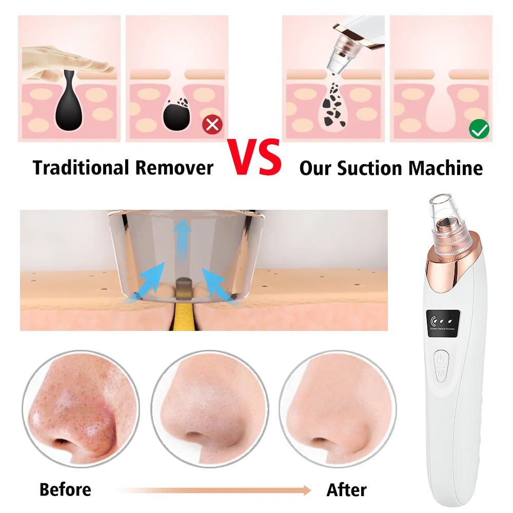 Beauty Electric Blackhead Remover Facial Cleaner Black Point Vacuum Suction Black Head Dots Remover Extractor Skin Care Tools [SKC]