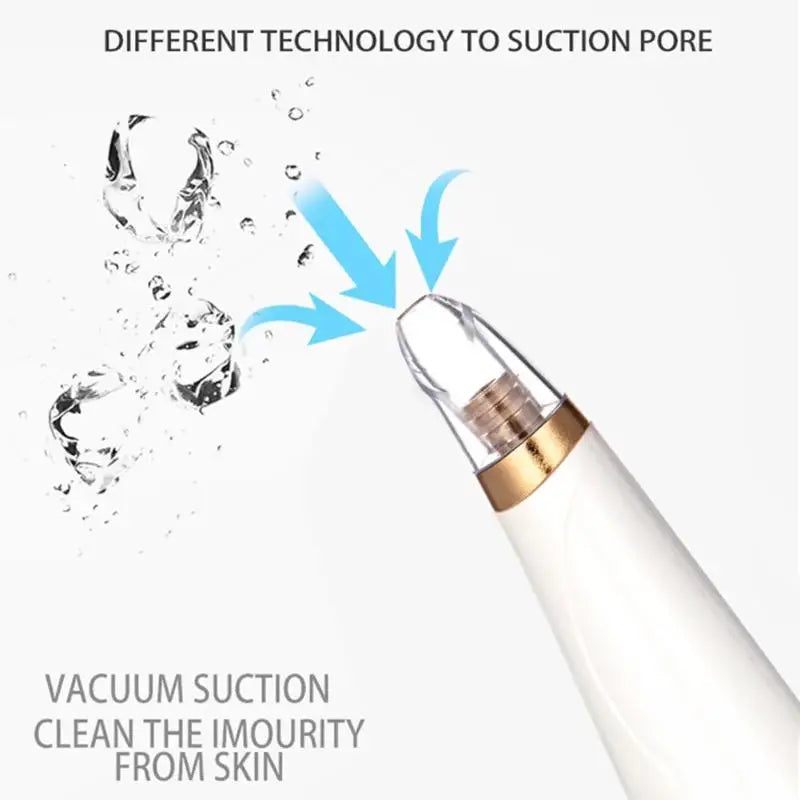 Vacuum Suction Electric Blackhead Remover Face Pimple Extraction Facial Deep Spots Pore Acne Removal Cleaner Skin Care Device [SKC]