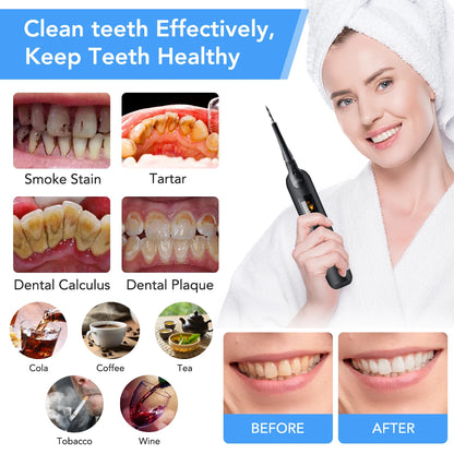 Sonic Dental Scaler Cleaning Teeth Cleaner Calculus Remover Irrigator Dental Tooth Whitening Device Electric Remove Tartar [DEN]