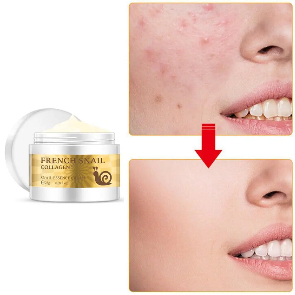 Snail Rejuvenating Face Cream Hyaluronic Acid Moisturizer Anti Aging Collagen Skin Care Health Nourishing Serum [SKC]