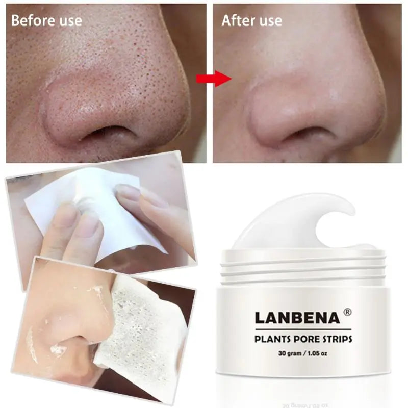 LANBENA Blackhead Remover Cream Paper Plant Pore Strips Nose Acne Cleansing Black Dots Peel Off Mud Mask Treatments Skin Care [SKC]