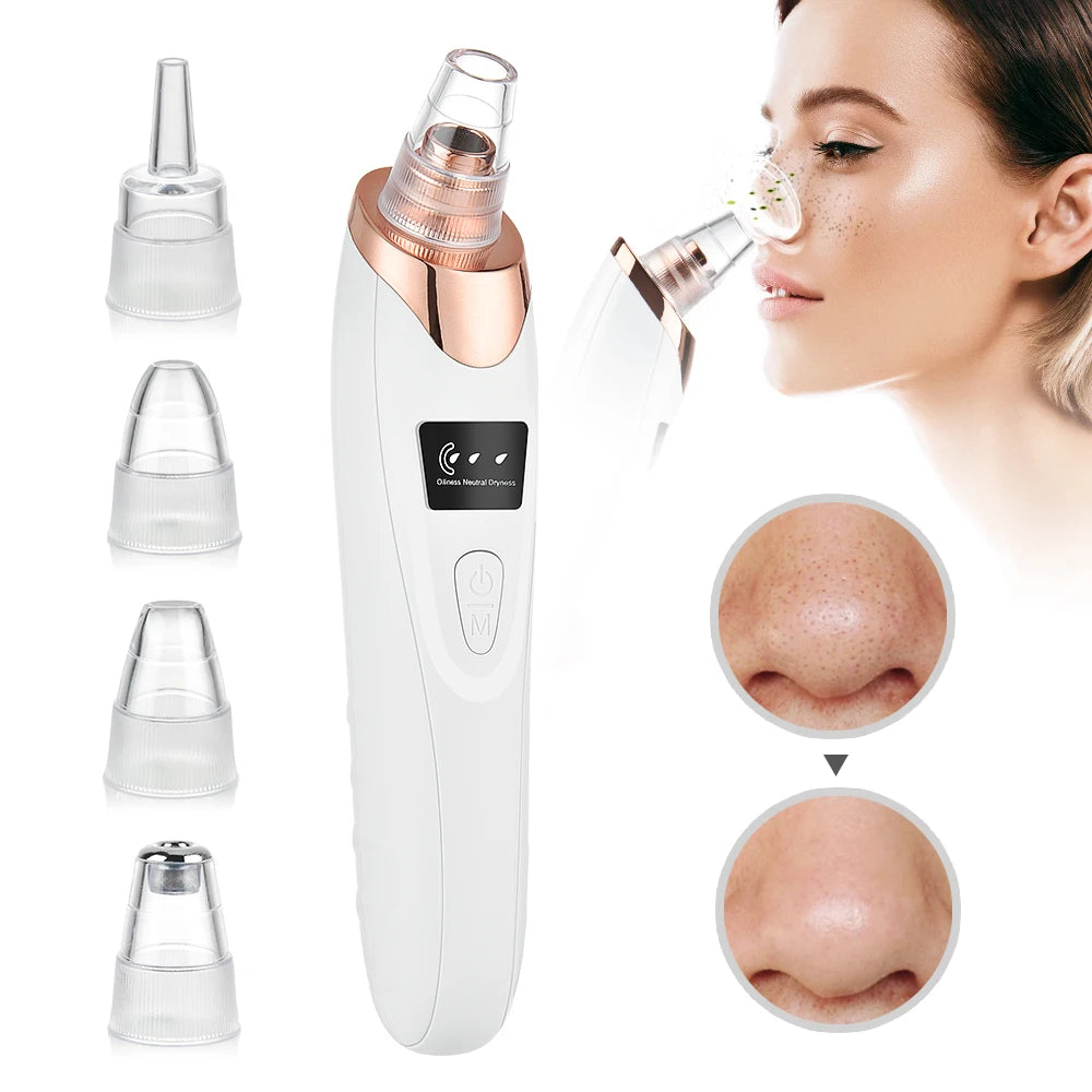 Beauty Electric Blackhead Remover Facial Cleaner Black Point Vacuum Suction Black Head Dots Remover Extractor Skin Care Tools [SKC]