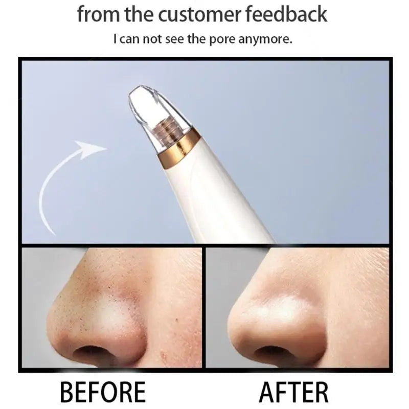 Vacuum Suction Electric Blackhead Remover Face Pimple Extraction Facial Deep Spots Pore Acne Removal Cleaner Skin Care Device [SKC]