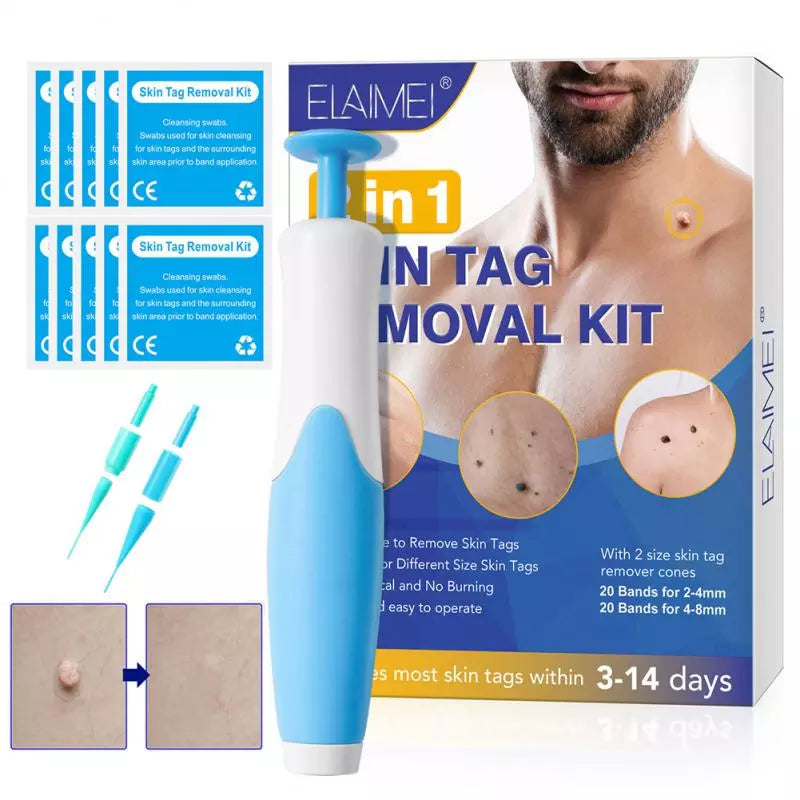 2 In1 Painless Auto Skin Tag Mole Wart Removal Kit Cleaning Tools Face Skin Care Body Wart Dot Treatments Remover Beauty Health [SKC]