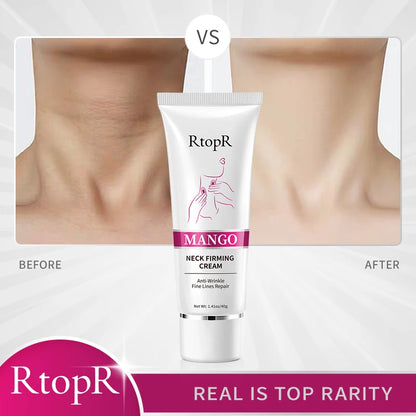 RtopR Neck Firming Wrinkle Remover Cream Rejuvenation Firming Skin Whitening Moisturizing Shape Beauty Neck Skin Care Products [SKC]