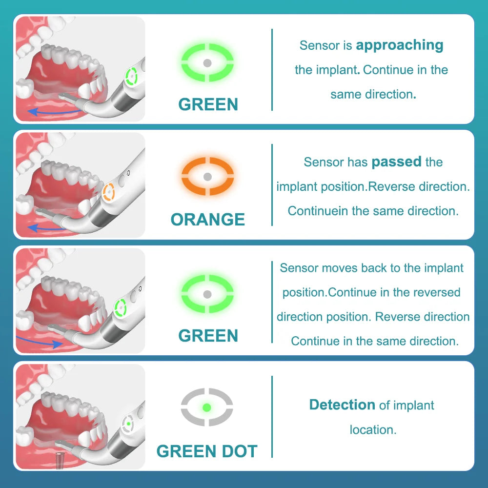 ID1 Implant Locator Accurate Cross-Scanning Spot Screwdriver Detector Tool 360 Rotatable Sensor Localization [MTL]