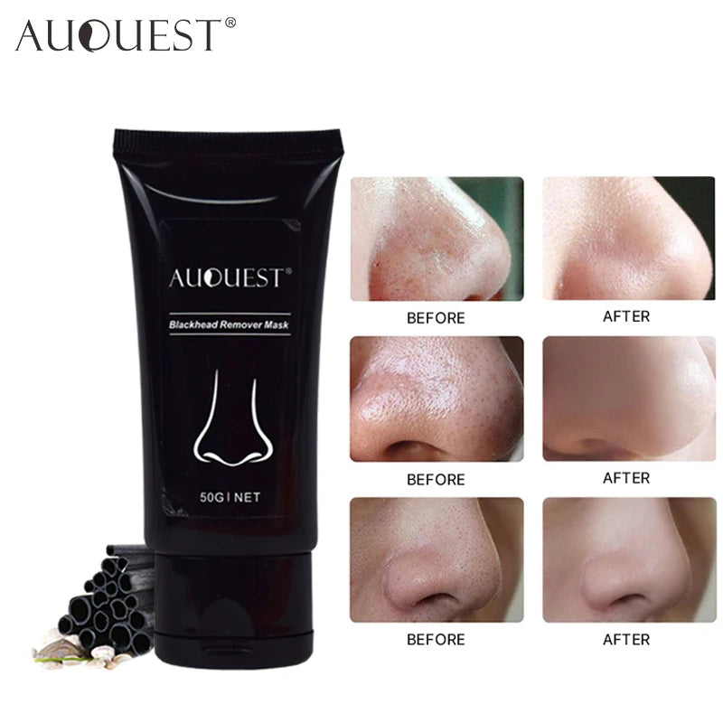 AUQUEST Blackhead Remover Face Mask Oil-Control Nose Black Dots Mask Acne Deep Cleansing Beauty Cosmetics for Women Skin Care [SKC]