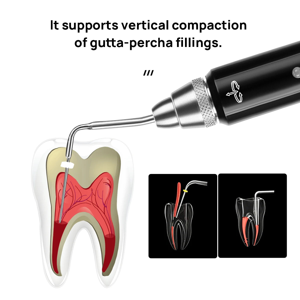 AZDENT Dental Cordless Gutta Percha Obturation System Endo Heated Pen 2 Tips Lab 3 Seconds Rapid Heating Endodontic Root Tools [DEN]