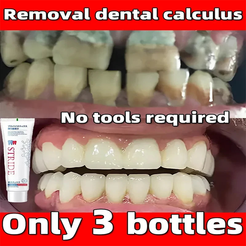 Dental Calculus Remover Whitening Teeth Toothpaste Mouth Odour Removal Bad Breath Remove Dental Plaque Preventing Periodontitis [DEN]