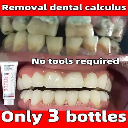 Dental Calculus Remover Whitening Teeth Toothpaste Mouth Odour Removal Bad Breath Remove Dental Plaque Preventing Periodontitis [DEN]