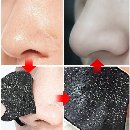 10/20/50PCS Nose Blackhead Remover Mask Deep Cleaning Skin Care Shrink Pore Acne Treatment Mask Nose Black dots Pore Clean Strip [SKC]