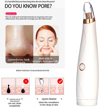 Vacuum Suction Electric Blackhead Remover Face Pimple Extraction Facial Deep Spots Pore Acne Removal Cleaner Skin Care Device [SKC]