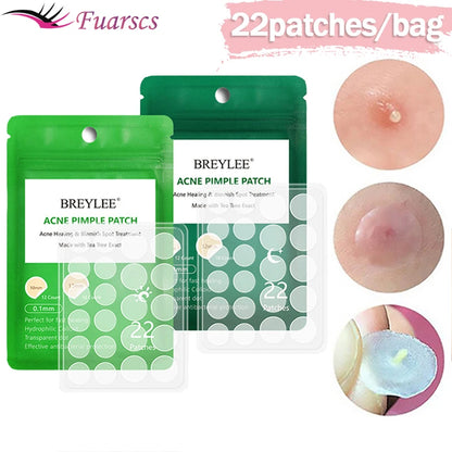 0.1mm Acne Pimple Patch Stickers Waterproof Acne Treatment Pimple Remover Tool Blemish Spot Facial Mask Skin Care 22 patches/bag [SKC]