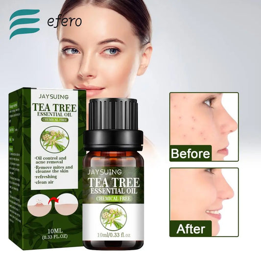 10ML Tea Tree Essential Oil Acne Marks Oil Control Facial Serum Moisturizing Hydration Firming Repair Essential Oil Skin Care [SKC]