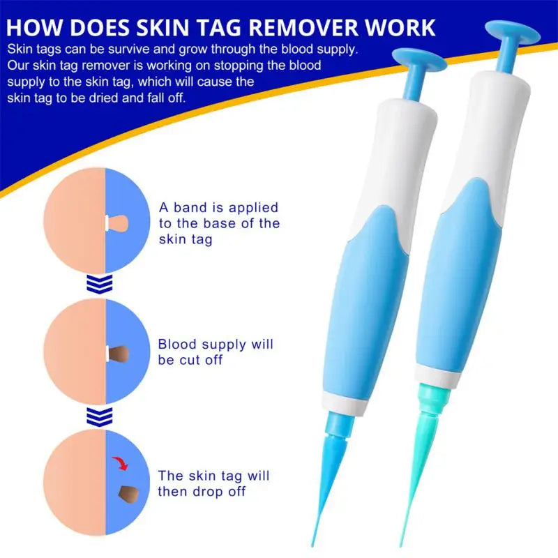 2 In1 Painless Auto Skin Tag Mole Wart Removal Kit Cleaning Tools Face Skin Care Body Wart Dot Treatments Remover Beauty Health [SKC]