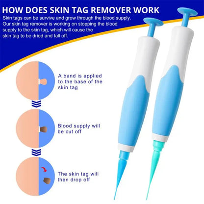 2 In1 Painless Auto Skin Tag Mole Wart Removal Kit Cleaning Tools Face Skin Care Body Wart Dot Treatments Remover Beauty Health [SKC]